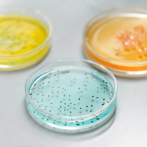 three-petri-dishes-with-yellow-blue-orange-cultures
